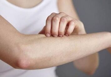 Psoriasis sur la main