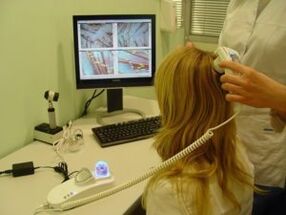 Diagnostic du psoriasis sur le cuir chevelu.