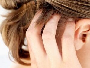 signes et symptômes du psoriasis sur le cuir chevelu